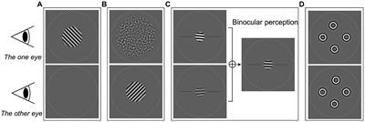 Binocular function in the aging visual system: fusion, suppression, and stereoacuity